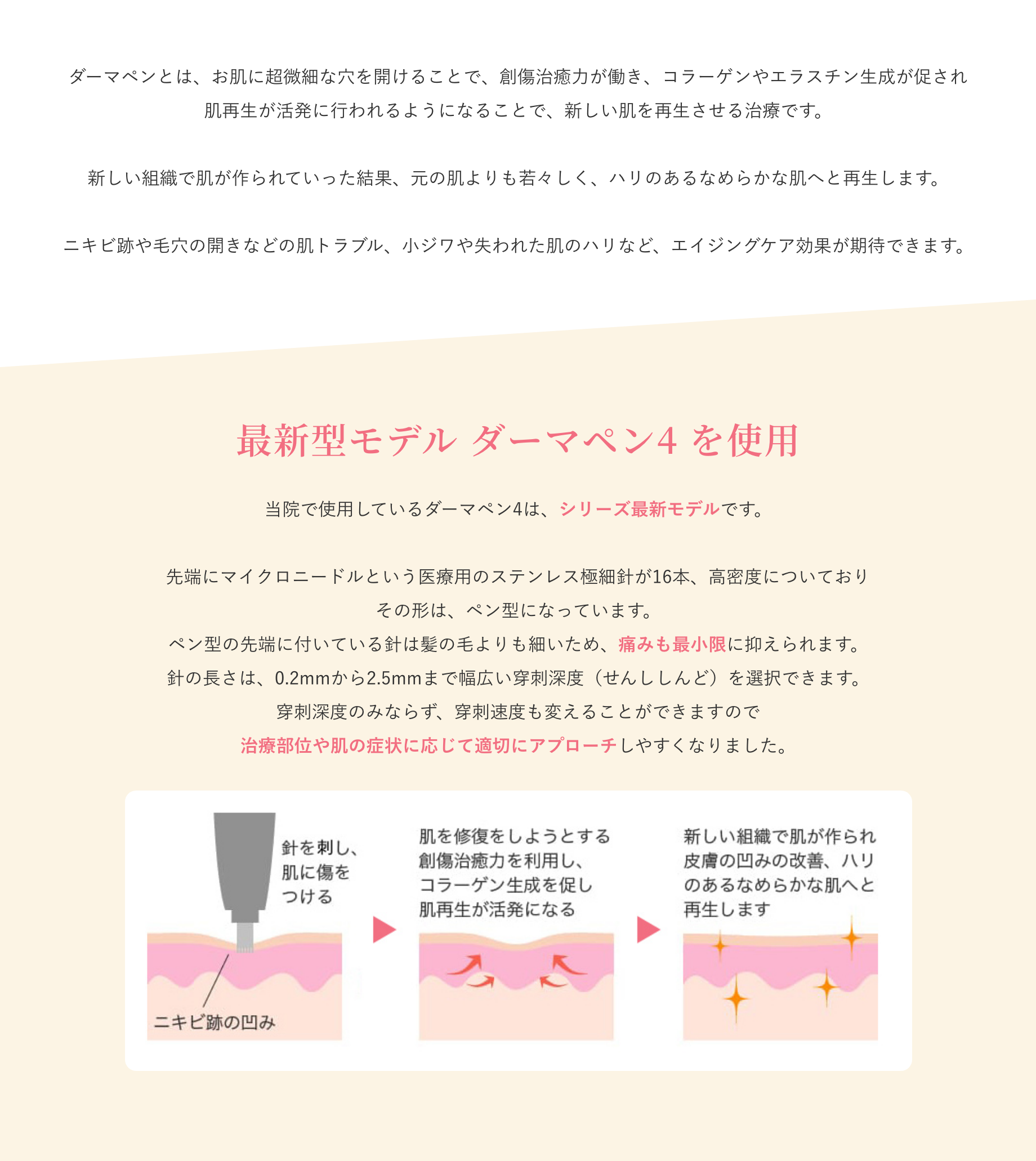 ダーマペンとは？