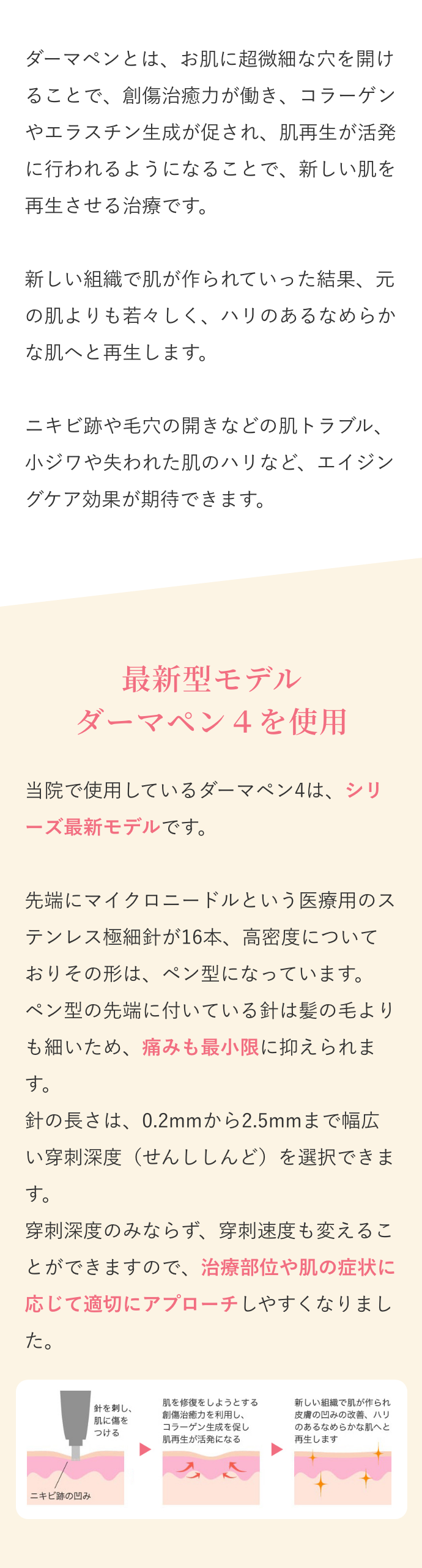 ダーマペンとは？