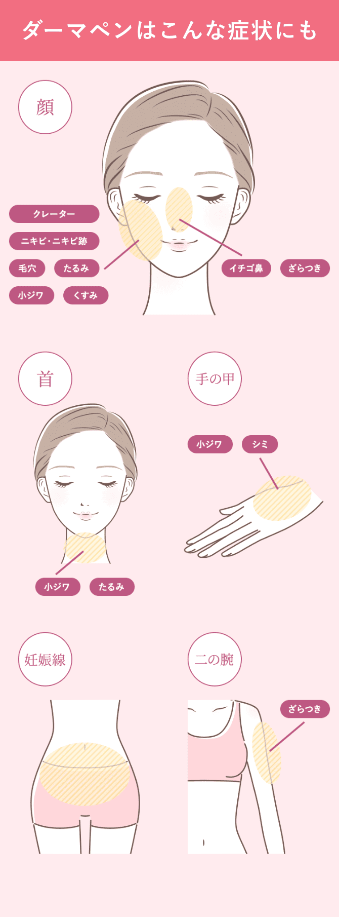 ダーマペンは肌以外にも