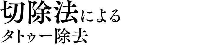 切除法によるタトゥー除去