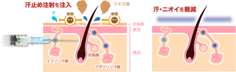 図解