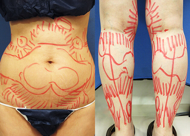 解剖学に基づいた美Bodyデザイン