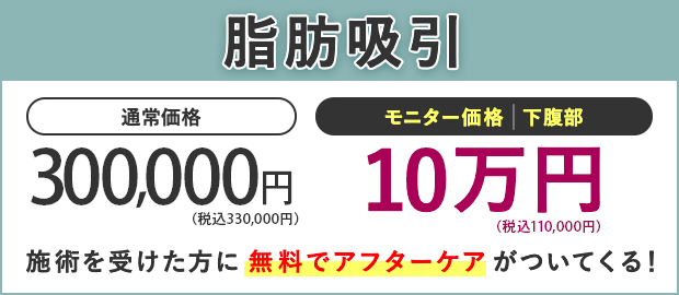 脂肪吸引モニター募集