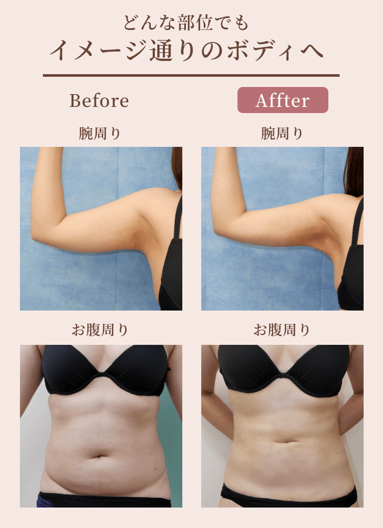 どんな部位でもイメージ通りのボディへ