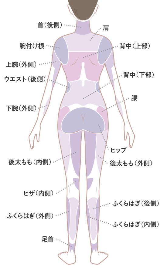 脂肪吸引 適応部位　後面