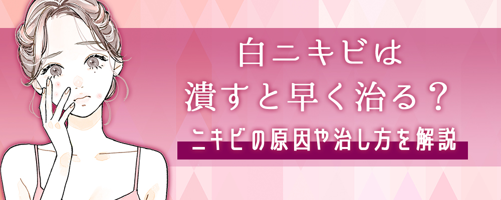 白ニキビは潰すと早く治る ニキビの原因や一晩で治す方法はあるのか解説します