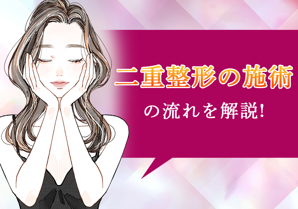 二重整形 施術の流れ