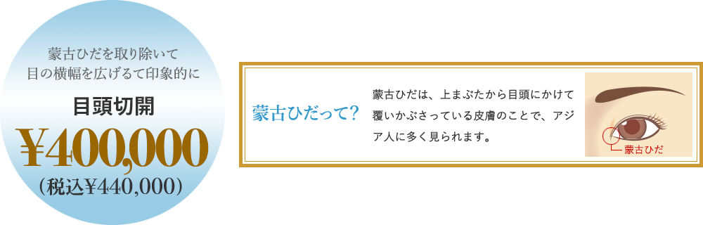 蒙古ひだを取り除いて目の横幅を広げて印象的に 目頭切開 ¥200,000 蒙古ひだって？ 蒙古ひだは、上まぶたから目頭にかけて覆いかぶさっている皮膚のことで、アジア人に多く見られます。