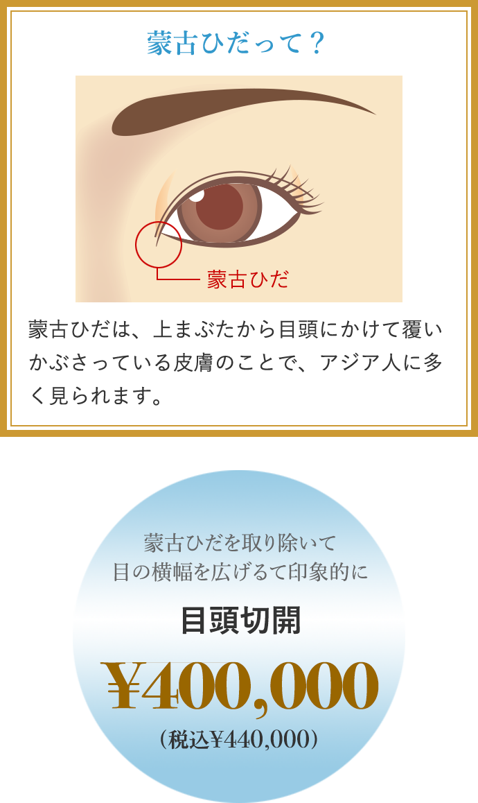 蒙古ひだを取り除いて目の横幅を広げて印象的に 目頭切開 ¥200,000 蒙古ひだって？ 蒙古ひだは、上まぶたから目頭にかけて覆いかぶさっている皮膚のことで、アジア人に多く見られます。