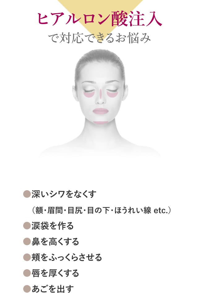 ヒアルロン酸注入で対応できるお悩み ●深いシワをなくす（額・眉間・目尻・目の下・ほうれい線 etc.） ●涙袋を作る ●鼻を高くする ●頬をふっくらさせる ●唇を厚くする ●あごを出す