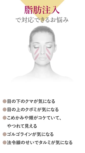 脂肪注入で対応できるお悩み ●目の下のクマが気になる ●目の上のクボミが気になる ●こめかみや頬がコケていて、やつれて見える ●ゴルゴラインが気になる ●法令線のせいでタルミが気になる