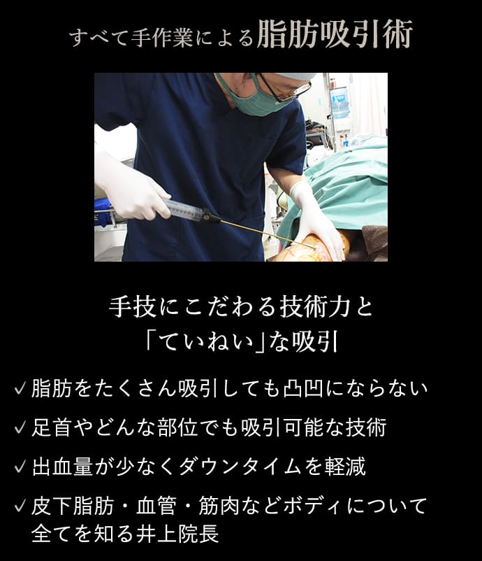 すべて手作業による脂肪吸引術 手技にこだわる技術力と｢ていねい｣な吸引 ✓脂肪をたくさん吸引しても凸凹にならない ✓足首やどんな部位でも吸引可能な技術 ✓出血量が少なくダウンタイムを軽減 ✓皮下脂肪・血管・筋肉などボディについて全てを知る井上院長