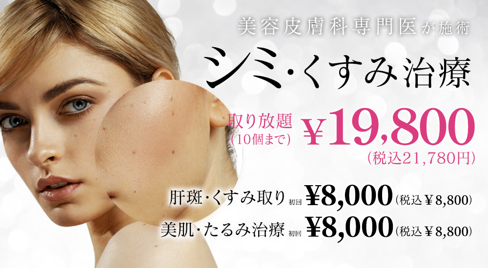 しみ・くすみ治療