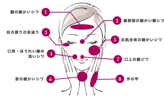 水光注射（ダーマクイーン）の施術ポイント