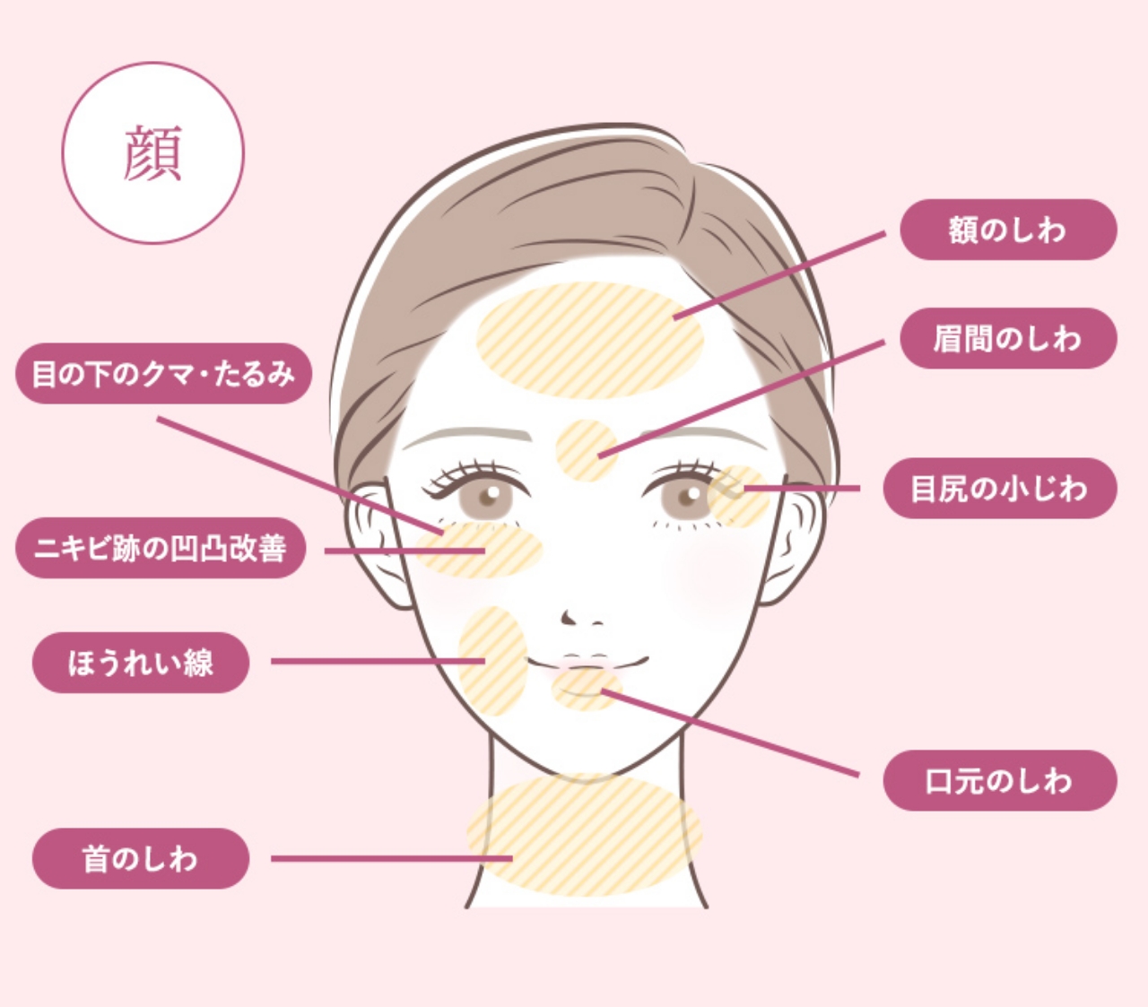NMN点滴療法の施術可能箇所
