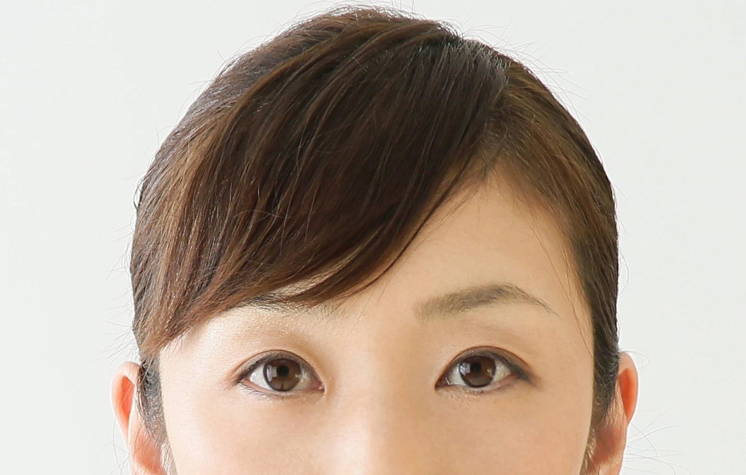 埋没式で二重にすると糸が取れる 確率と取れてしまったときにすべきこと 新宿美容外科クリニック 新宿院 立川院 横浜院 公式