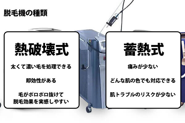 取り扱い脱毛機の種類