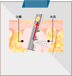 タイプ2