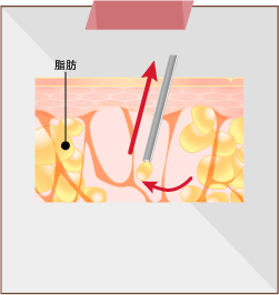 タイプ3